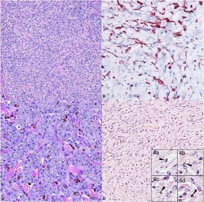 Canine melanoma: A review of diagnostics and comparative mechanisms of disease and immunotolerance in the era of the immunotherapies